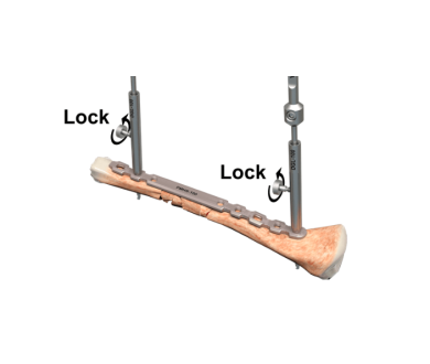 Guida perforatore con blocco