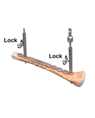 Guida perforatore con blocco